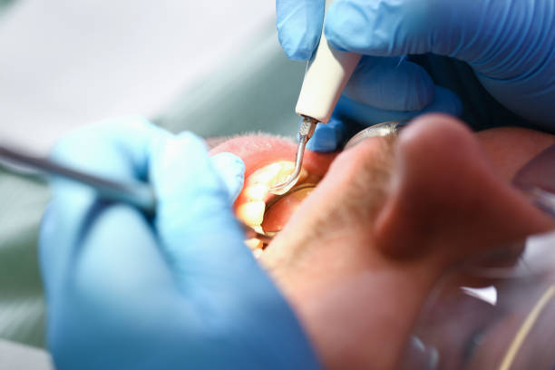 Best Emergency Dental Care for Trauma or Injury in Saint John Fisher College, NY