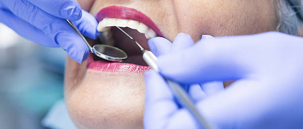 Best Emergency Treatment for Toothache in Saint John Fisher College, NY